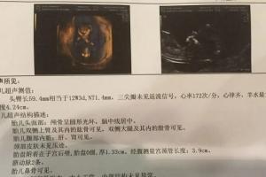 已生男宝的nt单子，nt值大于1.5毫米,说明怀的是男孩