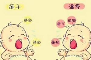 常见湿疹分为五种类型图片，不同类型的护理方法不相同
