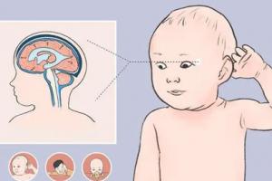 婴儿脑外积水早期症状有哪些？婴儿脑外积水的原因有哪些？