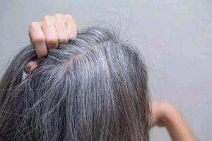 哪三个部位长白发最危险？长白发要如何调理？