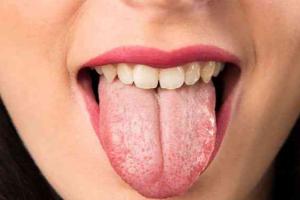 舌苔白又厚口干口苦是怎么回事？要如何调理改善？