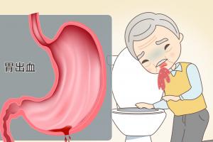 胃出血是什么原因引起的？胃出血要怎么办？