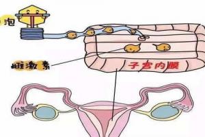 女性子宫内膜薄可以试管婴儿吗-建议先治疗