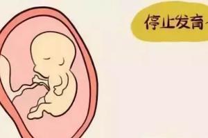 做试管婴儿还会发生胚胎停育吗-是可以避免的