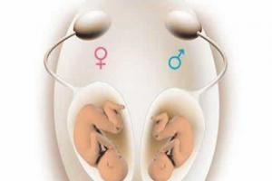 试管婴儿可以包生男孩-只要你能满足这个条件