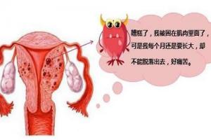 专家答疑高龄腺肌症能做试管婴儿-但要尽早