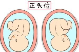 胎位臀位是睡太多的原因吗？极有可能是这3点原因导致的
