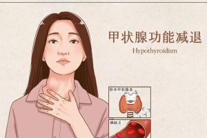 女性出现甲减最明显的7种症状，确认后需及时前往医院进行治疗