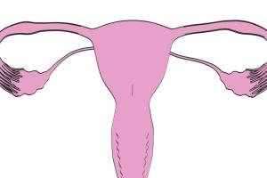 幼稚子宫做试管婴儿成功率大吗？得根据实际病情严重程度而定