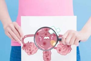 卵巢早衰又闭经两年在唐山哪个医院做试管婴儿不用等？仅一家医院可选择
