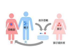 2022上半年国内试管婴儿医院排名前十，共536家北大三医名列前茅