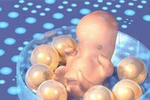 试管婴儿是可以确定生男生女的吗，技术上是允许的