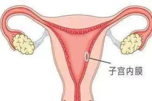 44岁子宫内膜薄能做试管婴儿吗？听听生殖专家怎么说