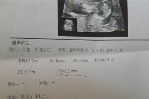 网传nt值看男女85%的准确率可信吗？生男生女这4个方法最靠谱