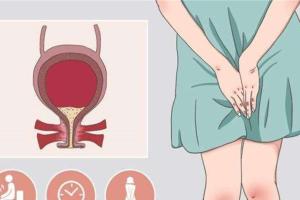 女性膀胱炎的症状表现？尿频、尿急、尿不尽