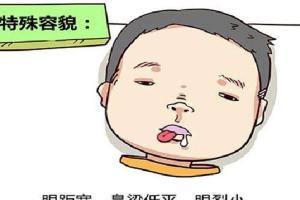 唐氏综合征是什么症状？智力发育缓慢、伸舌、眼斜