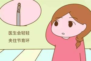 取环后的注意事项有哪些?7点来自一位取环生二胎妈妈的经验之谈
