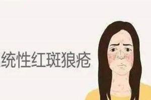 系统性红斑狼疮是什么症状？10大表现快速精准比对