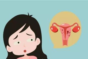 腺肌症能怀上孩子吗？3大办法提高怀孕几率