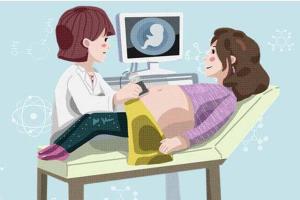 阴超可以检查哪些问题？宫外孕、多囊卵巢均在其列