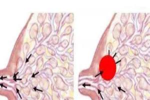 奶块怎么揉开6步，简单易学秒上手