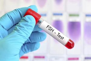 女性fsh数值大于28时还能自然怀孕吗？选对生育方案才是关键