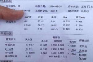 唐氏筛查正常值图片分享,依图比对又快又准