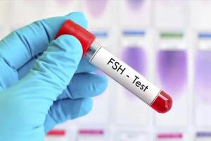 生殖专家解析女性fsh大于27时还能自然怀孕吗,自然怀孕的希望大吗