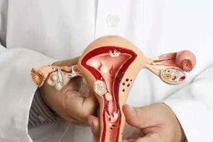 女性子宫腺肌症手术需要切除子宫吗？视情况而定不能一概而论