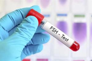 当女性fsh数值大于12时还能自然怀孕吗？带你了解fsh与生育之迷