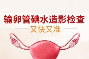 什么是输卵管造影