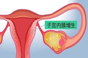 什么是子宫内膜增生