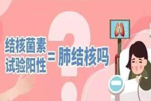 ppd试验强阳性可以做试管吗-需要分两种情况来讨论