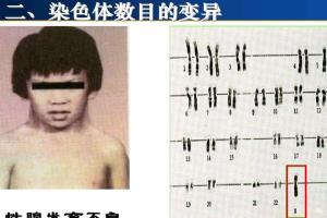 嵌合型特纳综合征能做试管婴儿吗？听听生殖专家怎么说