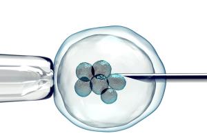 精子畸形高一定要做试管婴儿吗？精子畸形率高该人授还是试管？听听专家怎么说