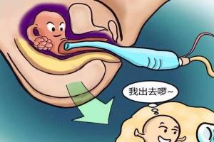 权威专家解读：关于试管婴儿取卵的几个常见问题
