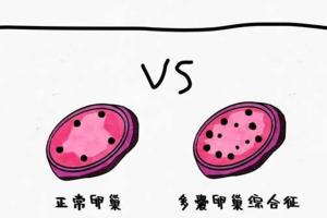 多囊备孕3年可以做试管吗-当然可以！过来人分享成功经验