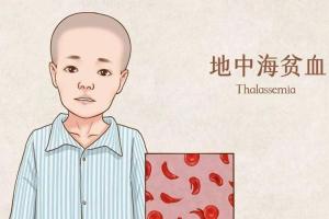 夫妻地贫能做第三代试管婴儿吗？生殖专家给出了这样的回答
