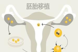 试管婴儿失败和这五个原因有关，快来看看你有没有中招