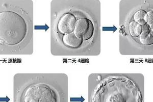 试管囊胚5bb和4bb哪个好？需要依据自身情况来进行判断