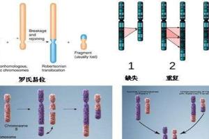 罗氏易位能做试管吗？听听生殖专家怎么说