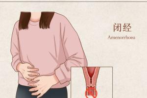 闭经的女性能够做试管婴儿吗？你想要的答案在这里