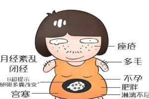 女性患有双侧多囊卵巢可以做试管婴儿吗？可以，需选择合适的促排方案