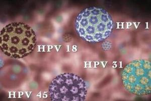 深度剖析hpv16阳性能不能做试管