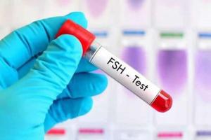 fsh11.36影响怀孕吗？不要拖延，生育才会有希望！