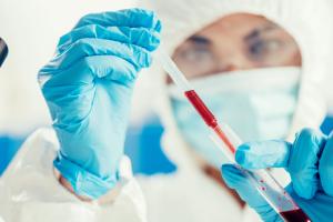 女方有乙肝可以做试管吗？专家解读试管婴儿有乙肝能做吗