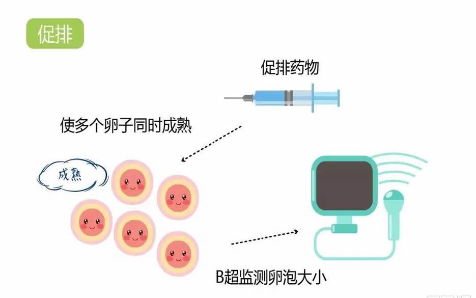 试管婴儿短方案到底取多少卵好-要根据自身情况而定