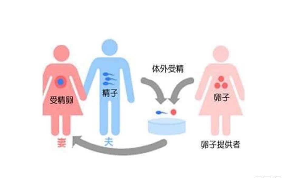 试管婴儿需要具备什么条件?这4个条件2个准备缺一不可