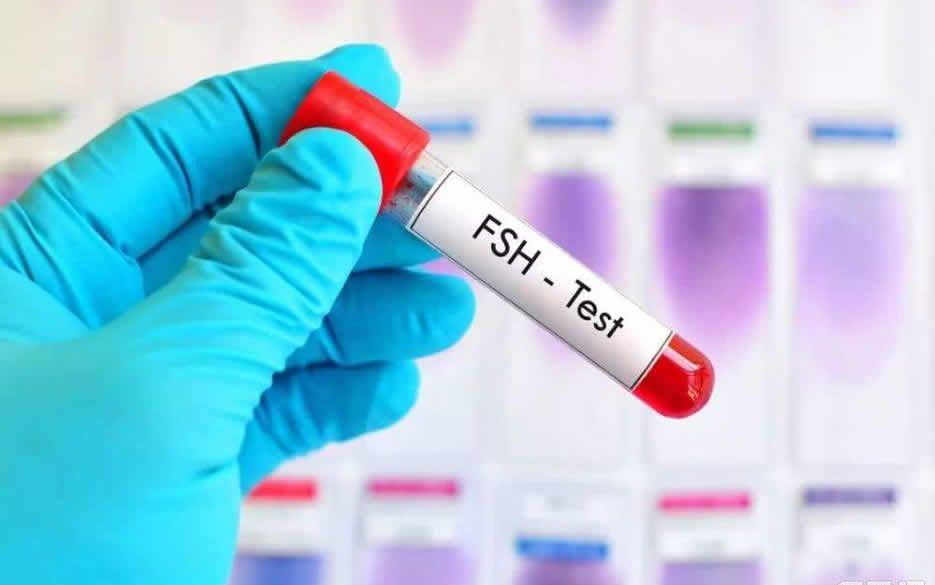FSH高于20还可以试管婴儿吗-答案是可以的