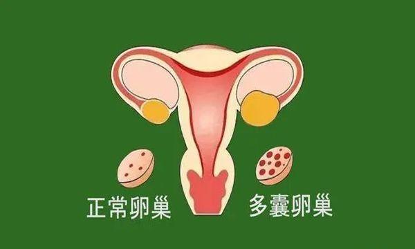 多囊可以直接促排卵立马做试管婴儿吗-建议先治疗